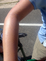A fly-covered arm, lovely!! (Cycling is not glamorous)